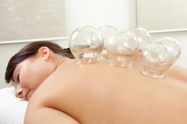 Acupuncture Cupping Treatment