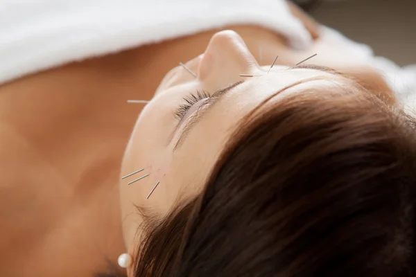 Facial Acupuncture Beauty Treatment