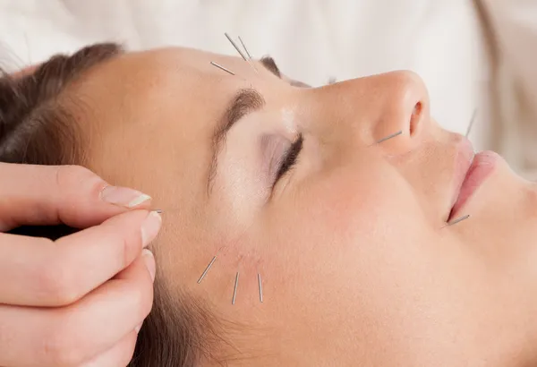 Facial Acupuncture Treatment Detail