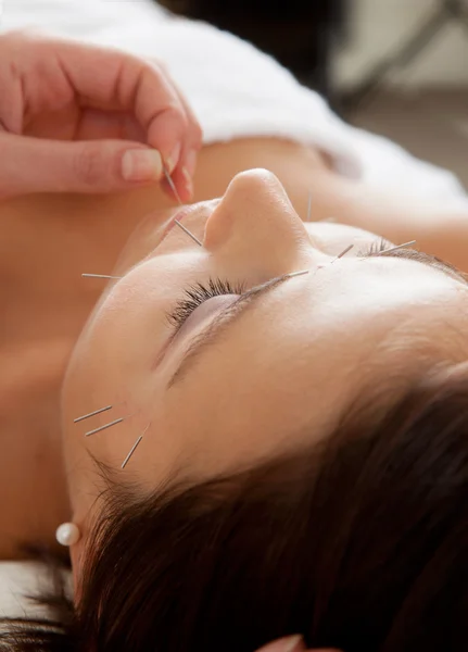 Facial Acupuncture Beauty Treatment