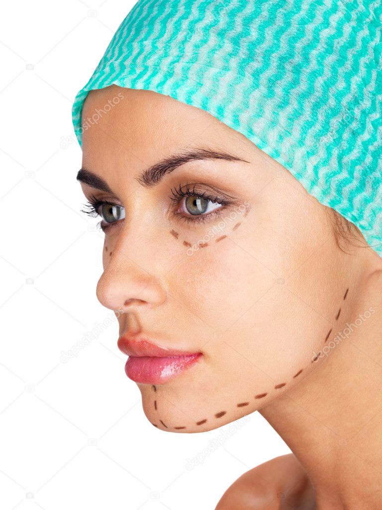 Drawn lines on a young woman face as marks for facial plastic surgery