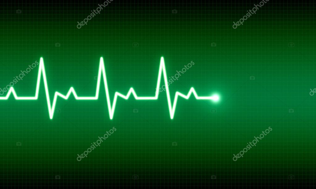 ekg trace