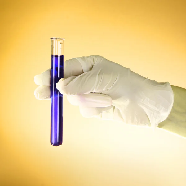 Test tube with liquid in the doctor's hand on the yellow backgro