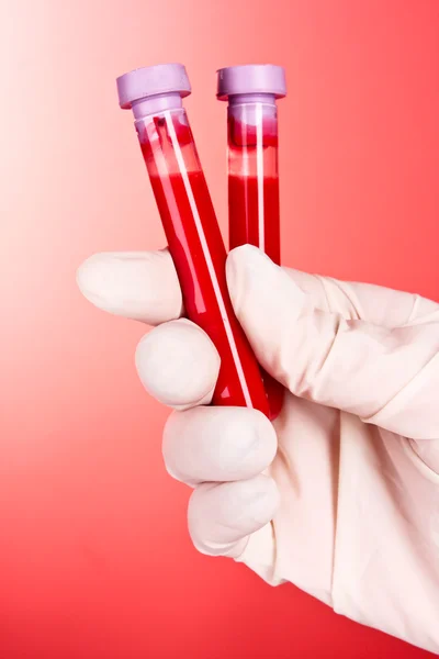 Doctor\'s hand in glove with blood test tubes on red background