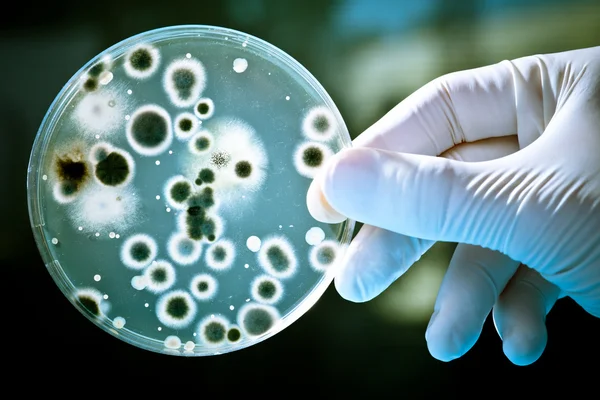 Petri Dish with Bacteria Culture