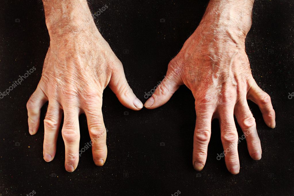 Wrinkled Hands