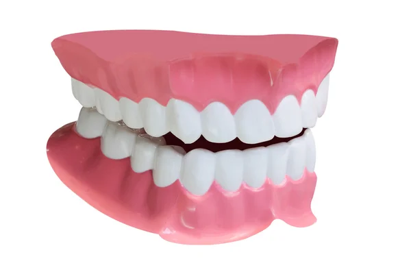 Takma dişler — Stok fotoğraf