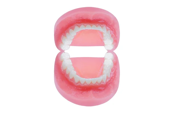 Protesi dentarie — Foto Stock