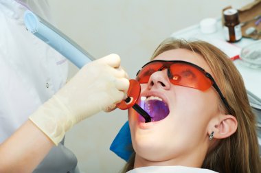 Dental filing of child tooth by ultraviolet light clipart