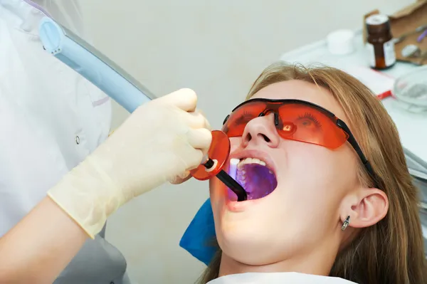 Dental filing of child tooth by ultraviolet light — Stock Photo, Image