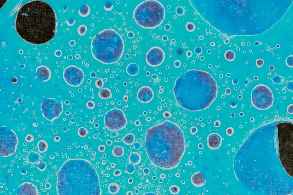 Cellules cancéreuses — Photo