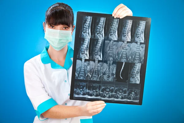 Доктор с рентгеном — стоковое фото