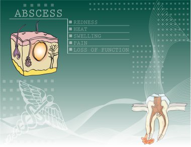 Background Abscess clipart