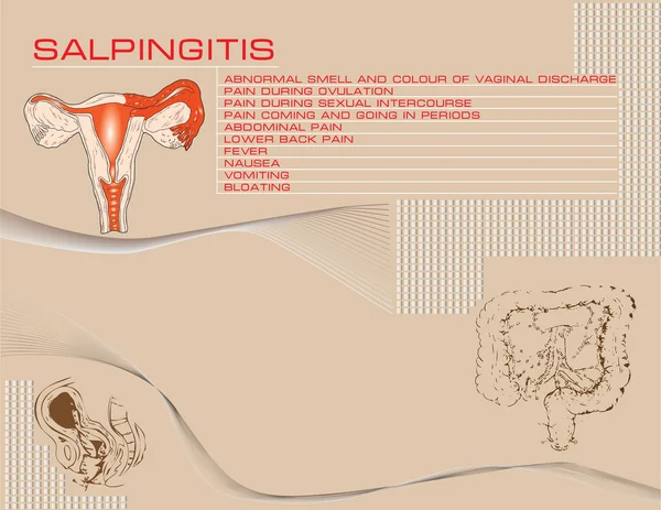 salpingitis arka plan