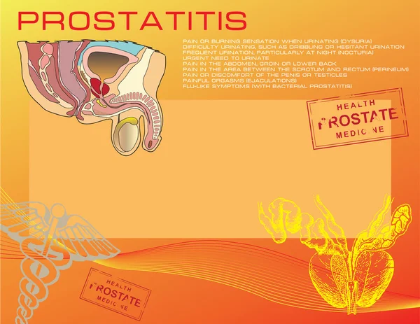 Prostatitis — Stockvector