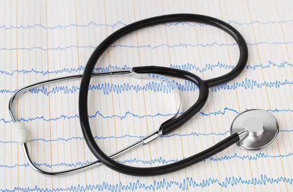 Stetoskop på EKG — Stockfoto