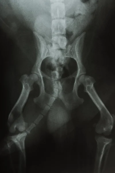 stock image X-ray