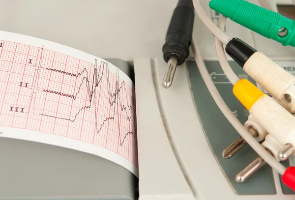 Máquina de electrocardiograma — Foto de Stock