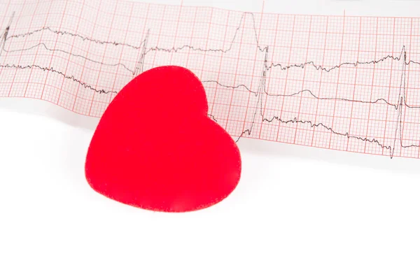 Électrocardiogramme avec un cœur — Photo