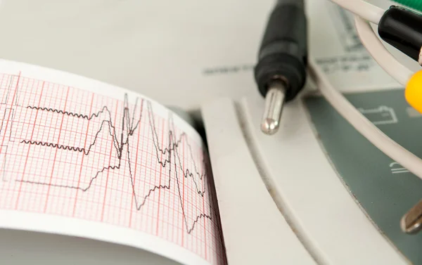 Electrocardiograph gép — Stock Fotó