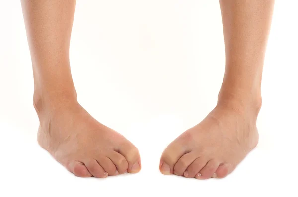 Усталые женские неуклюжие ноги — стоковое фото