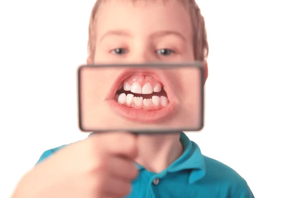 Menino mostra dentes através de lupa — Fotografia de Stock