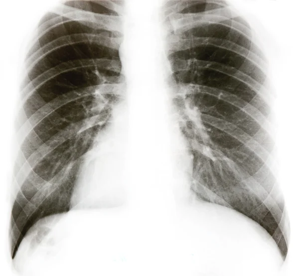 Рентгенівських знімки — стокове фото