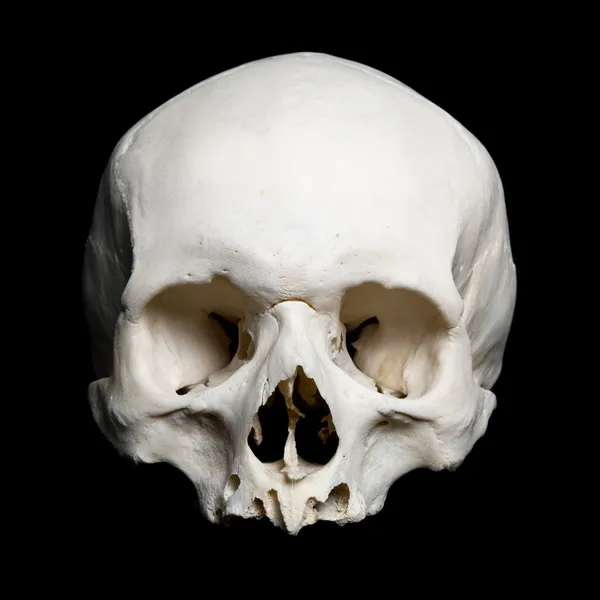 Верхняя половина настоящего человеческого черепа — стоковое фото