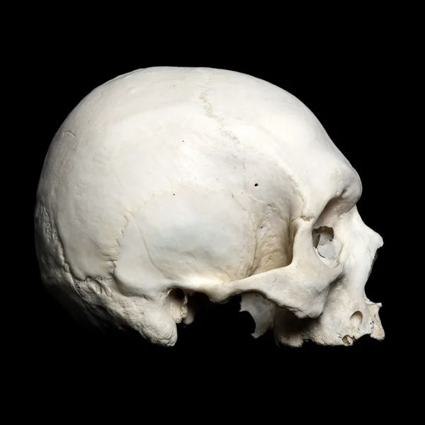 Верхня половина справжнього черепа людини — стокове фото