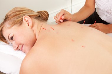 Back Shu Acupuncture clipart