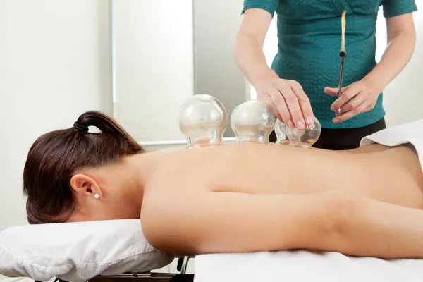 Tratamiento de acupuntura con ventosas en la espalda femenina —  Fotos de Stock