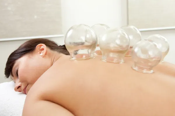 Acupuncture Cupping Treatment — Stock Photo, Image