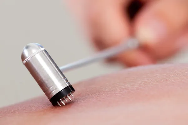 Plum bloesem acupunctuur gereedschap — Stockfoto