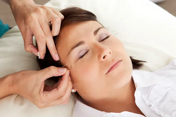 Acupunctuur therapeut plaatsen naald in gezicht — Stockfoto