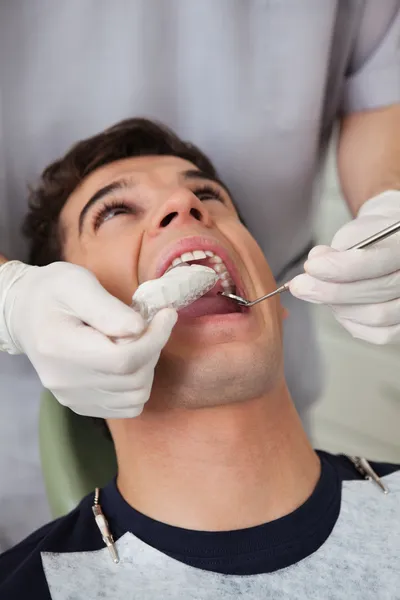 Dental Molds — Stock Photo, Image