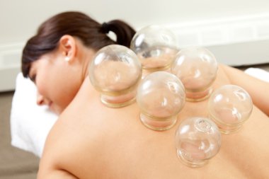 Detail of Woman with Acupuncture Cupping Treatment clipart