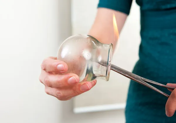 電球詳細をカッピング鍼治療 — ストック写真