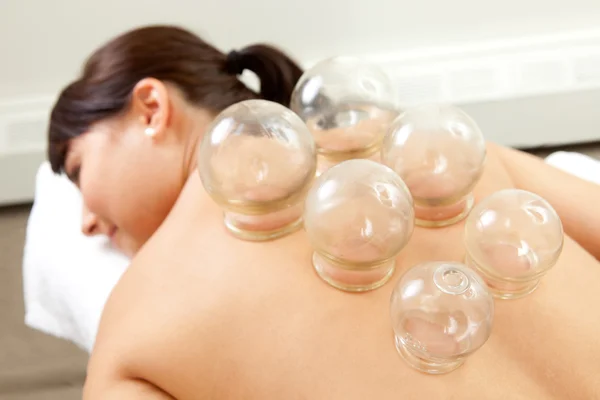 Detail of Woman with Acupuncture Cupping Treatment — Stock Photo, Image