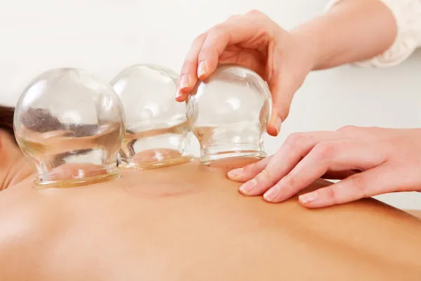 Fire Cupping Removal of Glass Globe — Stock Photo, Image
