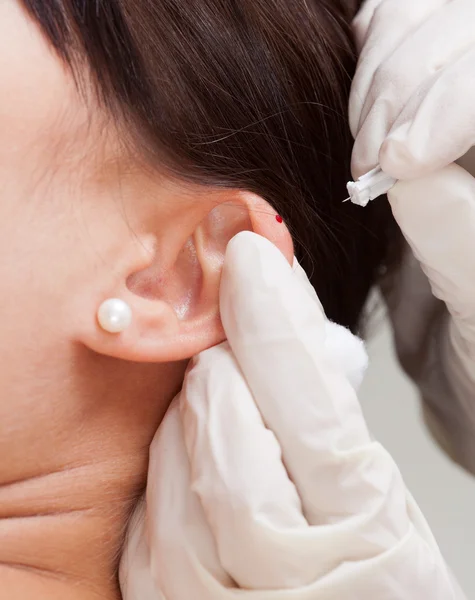 Kulak çevresi akupunktur detay — Stok fotoğraf