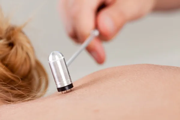 Plum bloesem acupunctuur behandeling — Stockfoto
