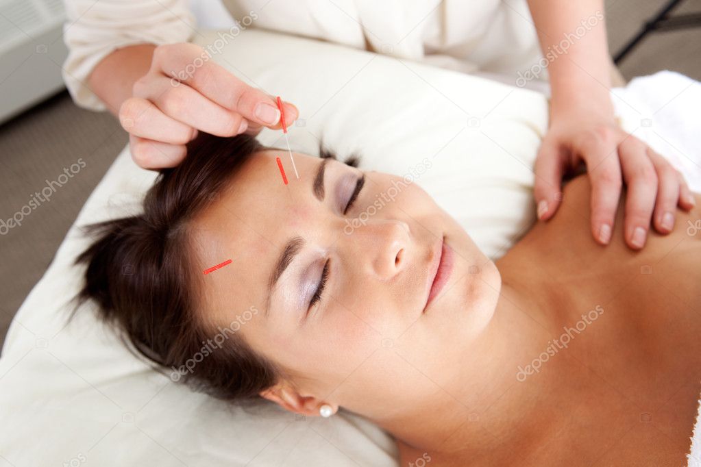 Facial Acupuncture Treatment Needle Stimulation