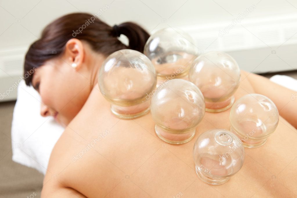 Detail of Woman with Acupuncture Cupping Treatment