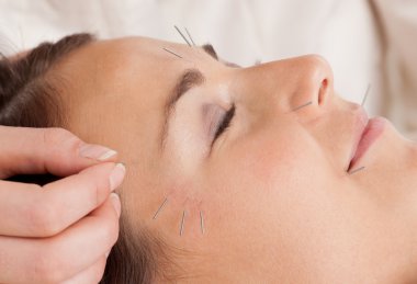 Facial Acupuncture Treatment Detail clipart