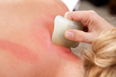 Redness During Gua Sha clipart