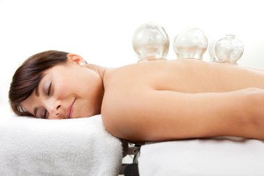 Female Receiving Acupuncture Cupping Treatment clipart