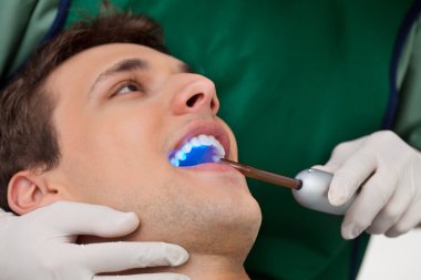 Dentist with UV Light clipart