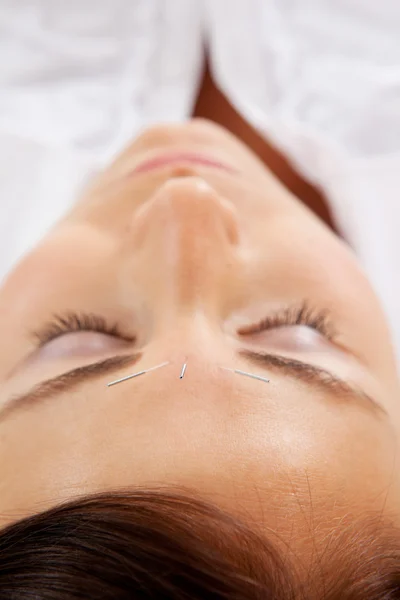 Akupunktura twarzy — Zdjęcie stockowe