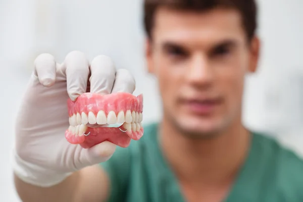 Male practitioner holding dental mold — Stock Photo, Image