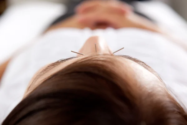 Akupunkturní ošetření obličeje detail — Stock fotografie